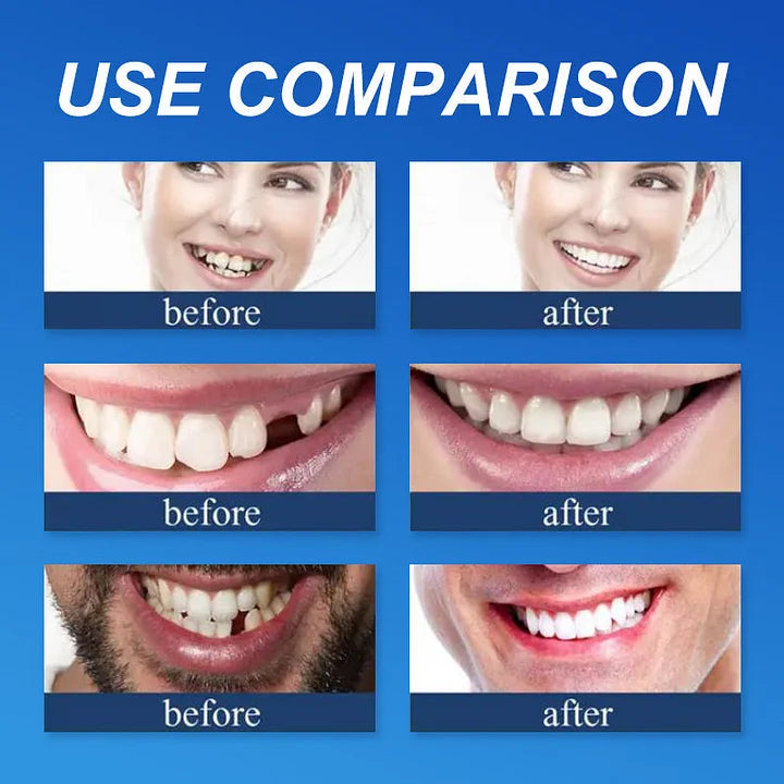 SmileLock – Helprotes med Stark Sugpassform