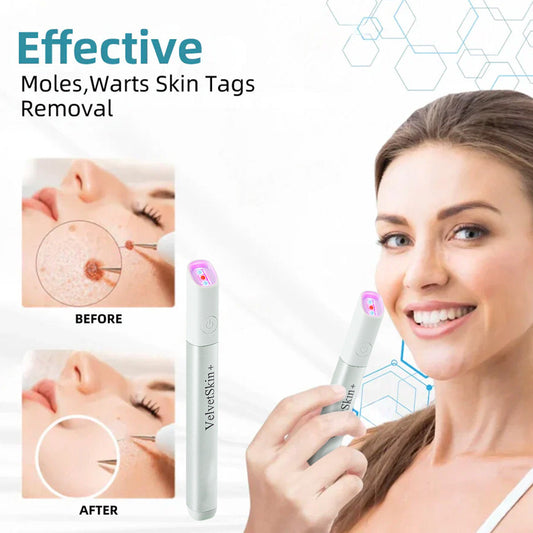 ✨VelvetSkin+™ All-in-One CO₂ Laser Eraser Pen | Removes Moles, Warts, Skin Flaws & Pigmentation