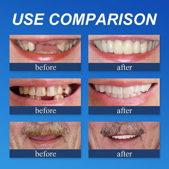 SmileLock – Helprotes med Stark Sugpassform